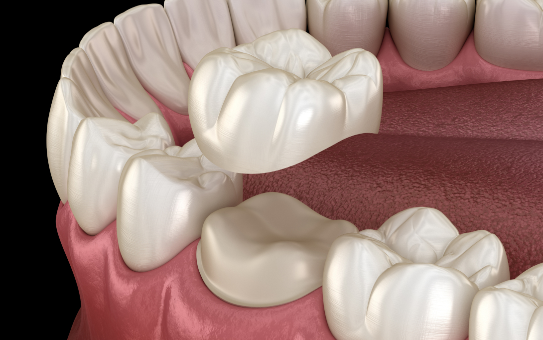 dental crown 3d render