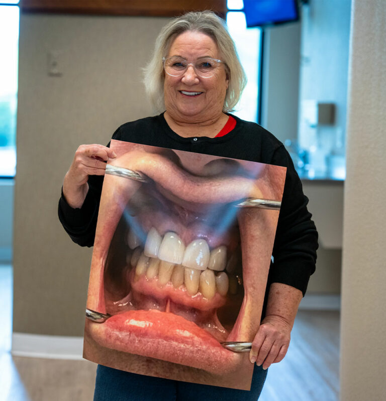Before & After Photos Kuzma DDS Fairfield, CA
